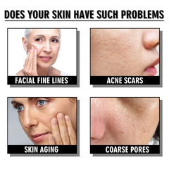 Snail Collagen Lifting Firming CreamđBuy 1 Get 1 Free (2Pcs)đ