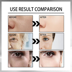 Snail Collagen Lifting Firming CreamđBuy 1 Get 1 Free (2Pcs)đ